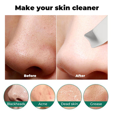Ultrasonic Facial Cleanser & Scrubber